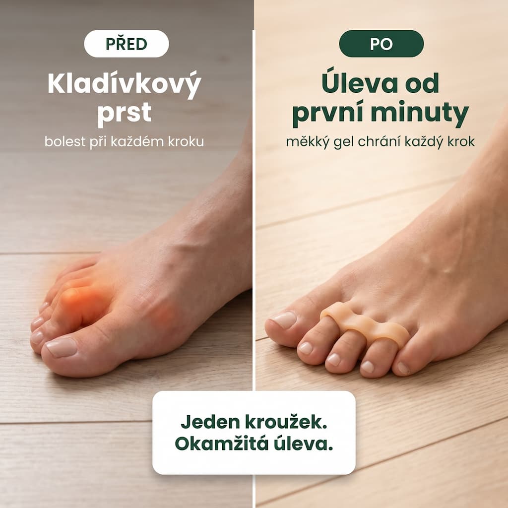 Silikonové oddělovače prstů před a po – úleva od kladívkového prstu